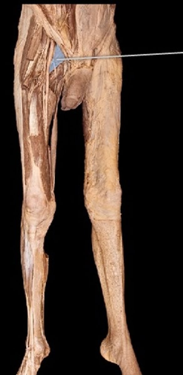 <p>What muscle is this?</p>