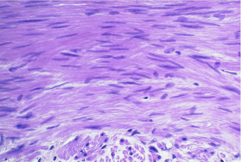 <p>what tissue is this </p>