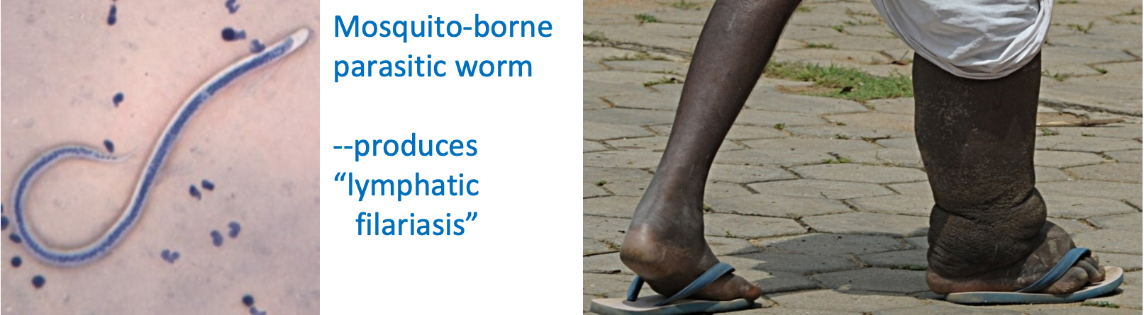 <ol><li><p>Normally, extra fluid that is filtered can be taken up by \n lymphatics and returned to plasma compartment at vena cava at right atria</p></li><li><p>Lymphatic obstruction = Edema</p><ol><li><p>e.g. elephantiasis</p><ol><li><p>Mosquito-borne parasitic worm</p><ol><li><p>produces “lymphatic filariasis”</p></li></ol></li></ol></li></ol></li></ol>