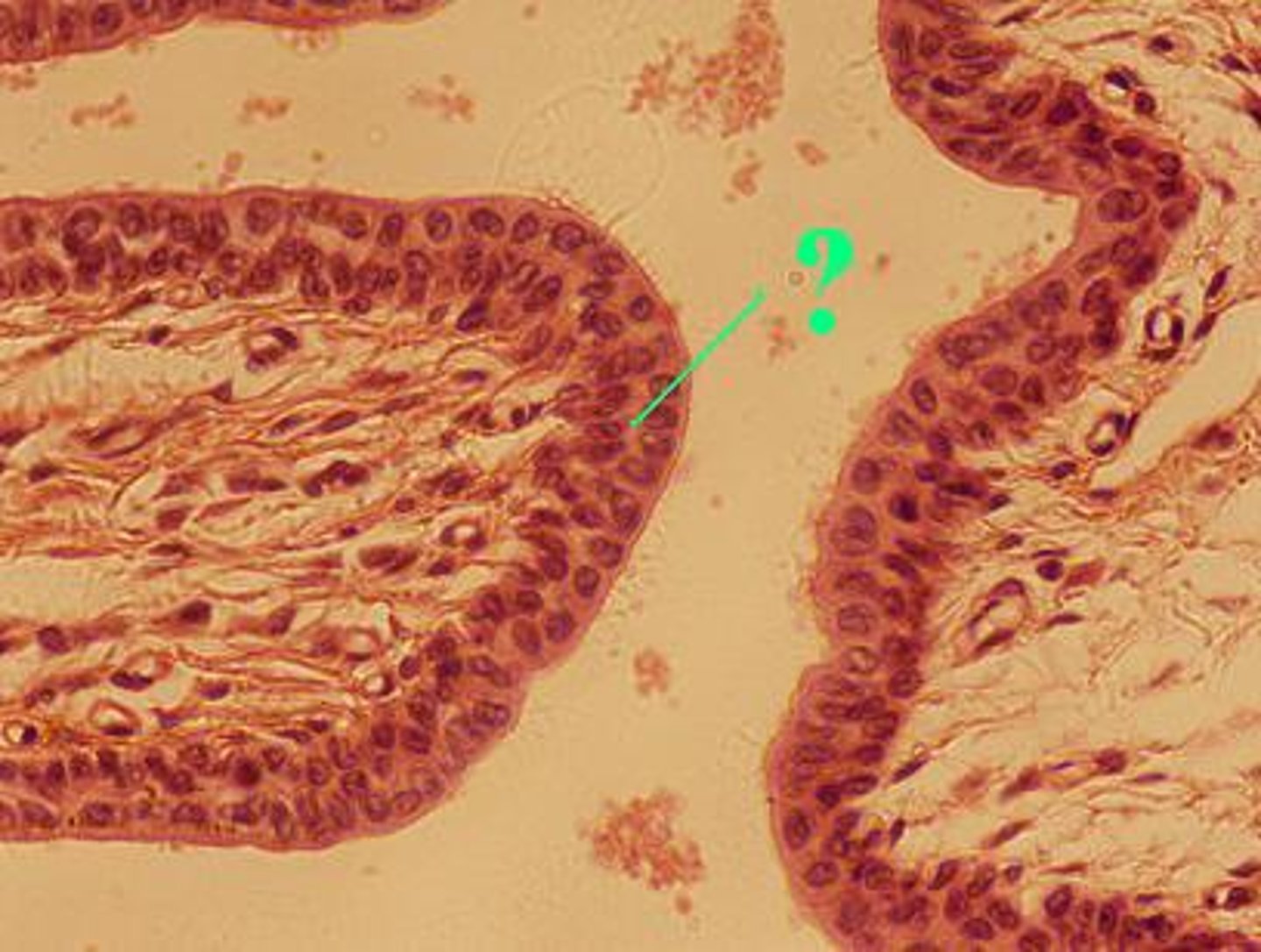 <p>What type of epithelium is present in this portion of the urethra?</p>