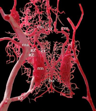 <p>A <strong>specialized arterial structure</strong> where an <strong>incurrent artery branches into many small interconnecting vessels</strong> and drains into an <strong>excurrent artery</strong>.</p><ul><li><p><u>Examples & functions:</u></p><ul><li><p>Glomeruli (kidney filtration)</p></li><li><p>Shark pseudobranch networks</p></li><li><p><strong>Red gland</strong> of swim bladders (regulates gas levels)</p></li><li><p>Oxygen storage in deep-diving mammals</p></li><li><p>Heat retention in mammals, birds, lamniform sharks, tuna</p></li></ul></li></ul><p></p>
