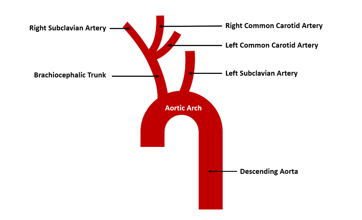 <p>The aortic arch is a curved portion of the main artery called the aorta. It bends over the heart and gives rise to branches that supply oxygenated blood to the head, neck, and upper limbs.</p>