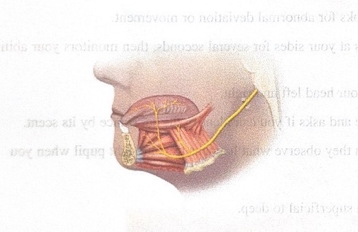 <p></p><p>Name this cranial nerve</p>