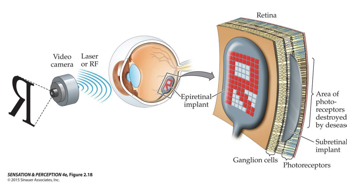 <ol><li><p>prosthetic retina - may replace damaged photoreceptors</p></li><li><p>Gene therapy - improve functioning in surviving photoreceptors </p></li><li><p>Chemical therapies - convert retinal ganglion cells into photoreceptors</p></li></ol><p></p>