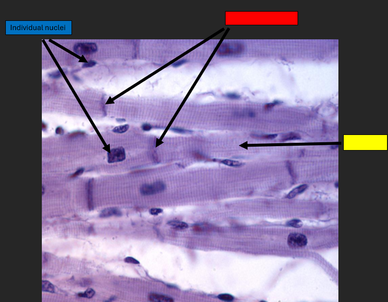 <p>Individual nuclei</p>