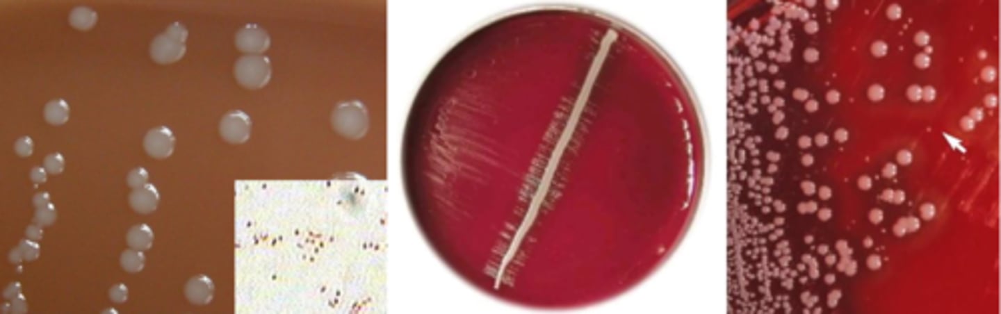 <p>-Growth on chocolate</p><p>-No growth on blood or MacConkey</p><p>-Can satellite around staphylococci to grow on blood</p>