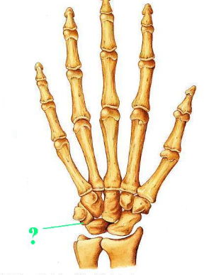 <p><span>Identify the indicated bone</span></p>