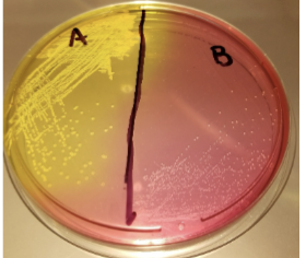 <p>Mannitol Salts Agar (MSA)</p>