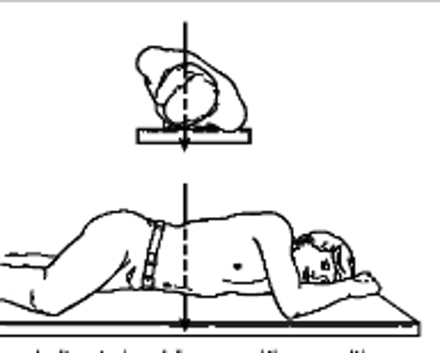 <p>What type of projection is this?</p><p>a. Right AP Oblique</p><p>b. Right PA Oblique</p><p>c. Left AP Oblique</p><p>d. Left PA Oblique</p>