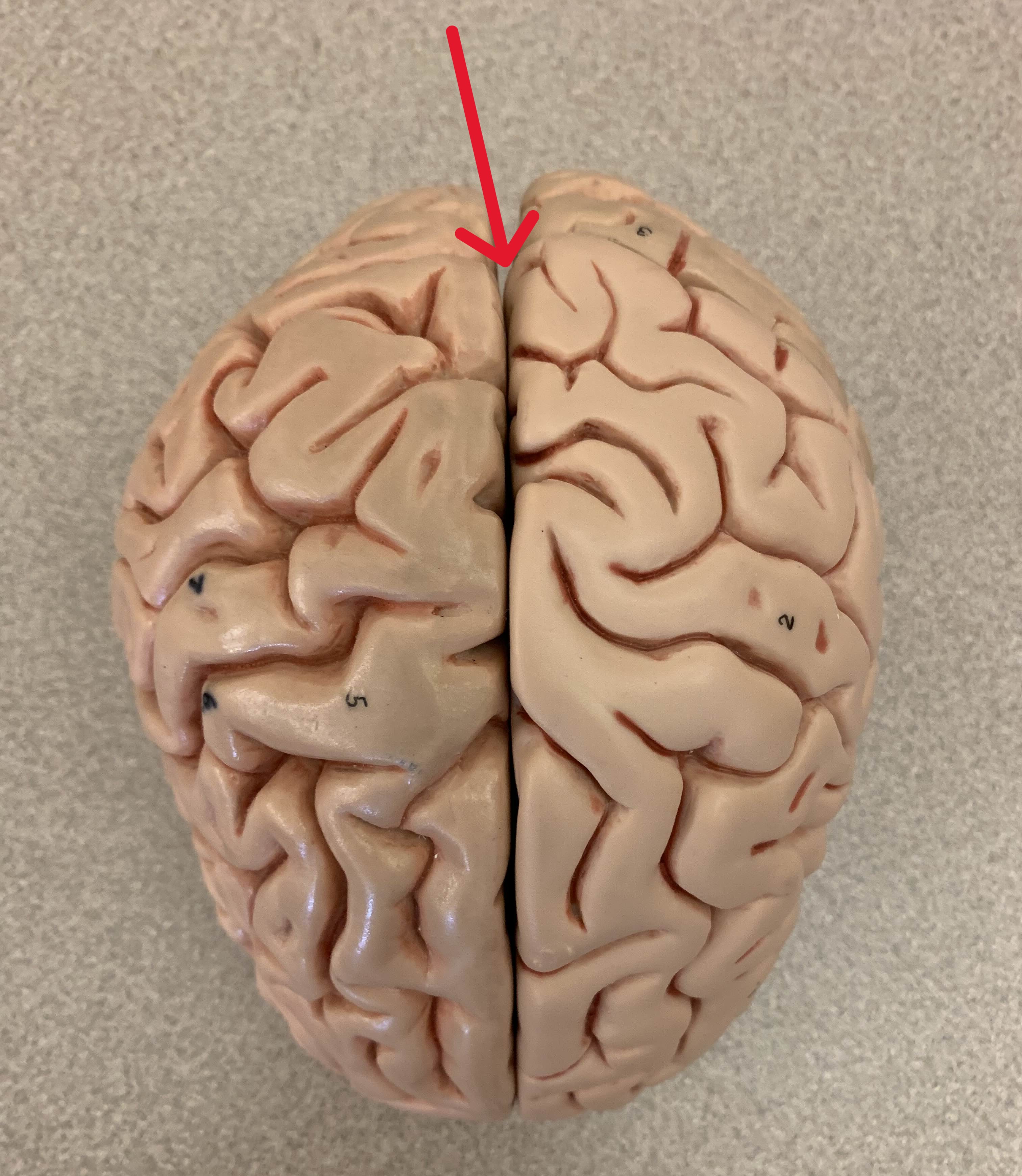 <p>Which part of the brain is:</p><ul><li><p>Divides left and right hemispheres of brain</p></li></ul><p></p>