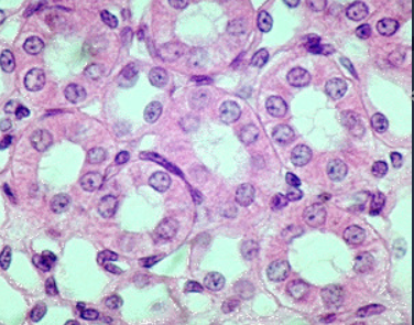 <p>1. kidney tubules<br>2. secretory portions of small glands<br>3. ovary surface</p>
