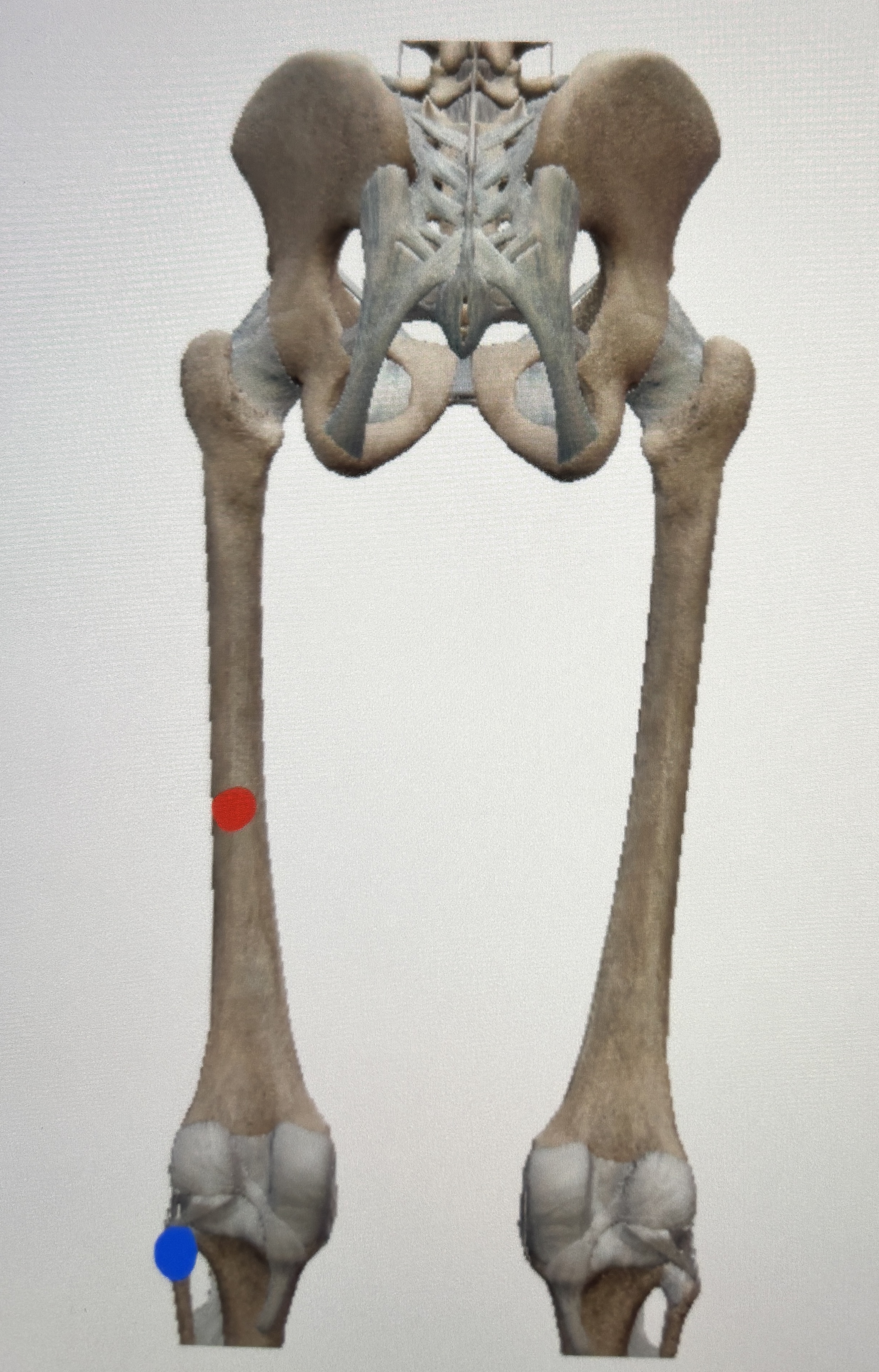 <p>What it this muscle </p>