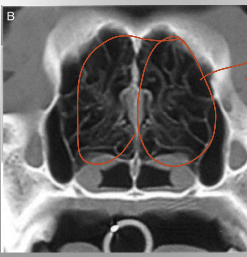 identify and explain what it does 