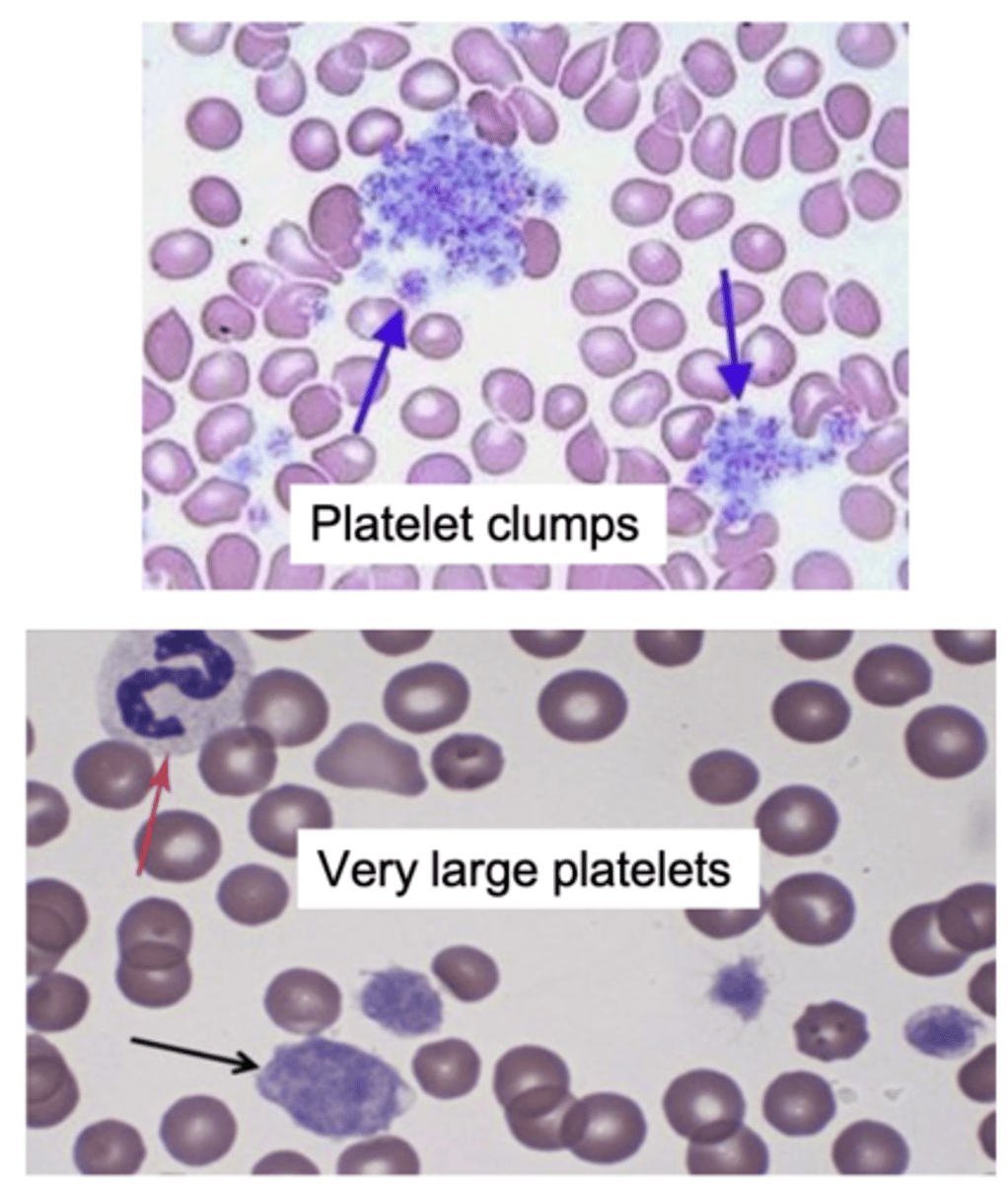 <p>1.) clumped or large platelets</p><p>2.) clumped erythrocytes</p><p>(agglutination)</p><p>3.) excessive Heinz bodies</p>