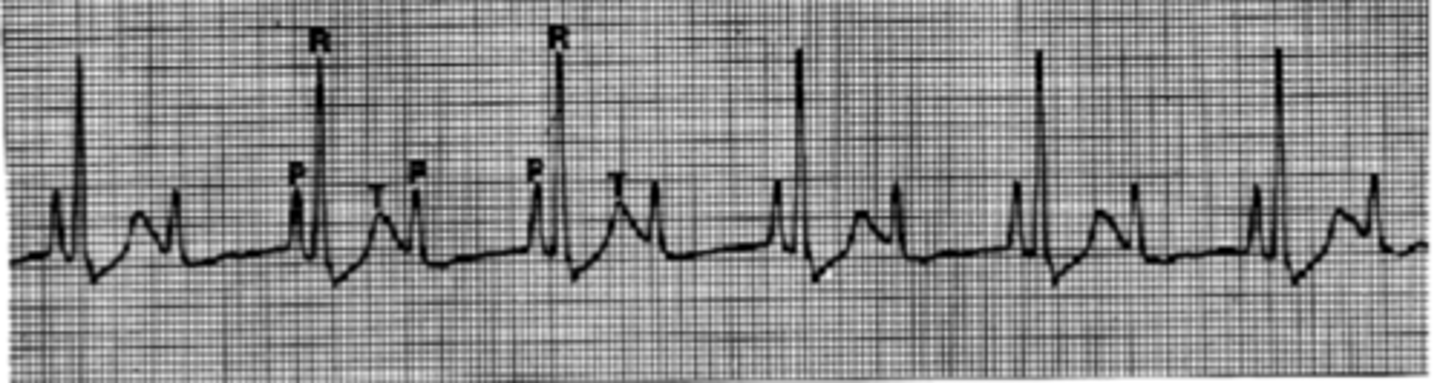 <p>Describe the heart rhythm</p>