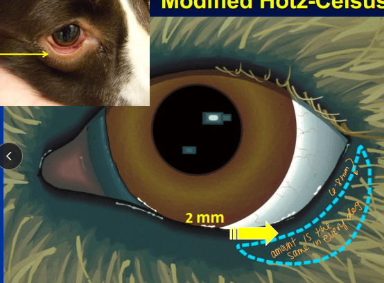 <ul><li><p><span style="background-color: transparent;"><strong><span>Et: </span></strong><u><span>Inward rolling</span></u><span> of the eyelid margin</span></span></p><ul><li><p><span style="background-color: transparent;"><strong><span>Cats:</span></strong><span> lateral canthal, unilateral</span></span></p></li><li><p><span style="background-color: transparent;"><strong><span>Sm dogs</span></strong><span>: medial canthal </span></span></p></li></ul></li><li><p><span style="background-color: transparent;"><strong><span>Cs: </span></strong><span>corneal irritation</span></span></p></li><li><p><span style="background-color: transparent;"><strong><span>Tx:</span></strong></span></p><ul><li><p><span style="background-color: transparent;"><strong><span>**Modified Hotz-Celsus Procedure: </span></strong><span>Permanent</span></span></p><ul><li><p><span style="background-color: transparent; color: rgb(176, 176, 176);"><span>Incision made approximately </span></span><span style="background-color: transparent; color: red;"><strong><u><span>2 mm from eyelid margin(hairline)</span></u></strong></span></p></li><li><p><span style="background-color: transparent; color: rgb(176, 176, 176);"><span>Small elliptical section of skin is removed</span></span></p></li><li><p><span style="background-color: transparent; color: rgb(176, 176, 176);"><span>6-0 Surgilene in </span></span><span style="background-color: transparent; color: red;"><span>simple interrupted pattern(start in the middle)</span></span></p></li></ul></li><li><p><span style="background-color: transparent;"><strong><span>Permanent Lateral Canthoplasty: </span></strong><span>lateral canthal entropion</span></span></p><ul><li><p><span style="background-color: transparent; color: rgb(176, 176, 176);"><span>Ends should be tucked away from the cornea</span></span></p></li></ul></li><li><p><span style="background-color: transparent;"><strong><span>Permanent Medial Canthoplasty</span></strong><span>: Medial Canthal Entropion</span><u><span> </span></u></span><span style="background-color: transparent; color: red;"><strong><u><span>Pugs</span></u></strong></span></p><ul><li><p><span style="background-color: transparent; color: rgb(176, 176, 176);"><span>Excision of caruncular tissue, reduces eyelid length medially</span></span></p></li></ul></li></ul></li></ul><img src="https://knowt-user-attachments.s3.amazonaws.com/d1f4e3dd-5d31-4238-b6ca-2a0820d0e38a.png" data-width="50%" data-align="center"><ul><li><p>1st Q - How old is the dog? fix them while you can</p><ul><li><p>remove the caruncle </p></li></ul></li></ul><p></p>