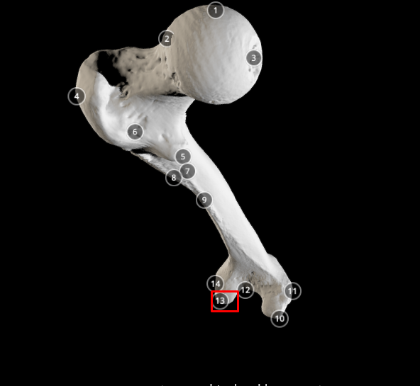 <p>lateral condyle (of femur) - on the greater trochanter side</p>