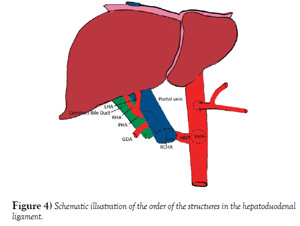 <p><strong><u>proper hepatic artery, hepatic portal vein, and the common bile duct</u></strong></p><p><br><strong>Hepatic artery - </strong>A branch of the common hepatic artery that originates from the celiac trunk</p><p><strong>Portal vein - </strong>The main drainage site for the small and large intestines and spleen, carrying nutrient-rich but oxygen-poor blood</p><p><strong>Common bile duct - </strong>A tube-like structure that carries bile from the gallbladder to the duodenum</p><p></p>