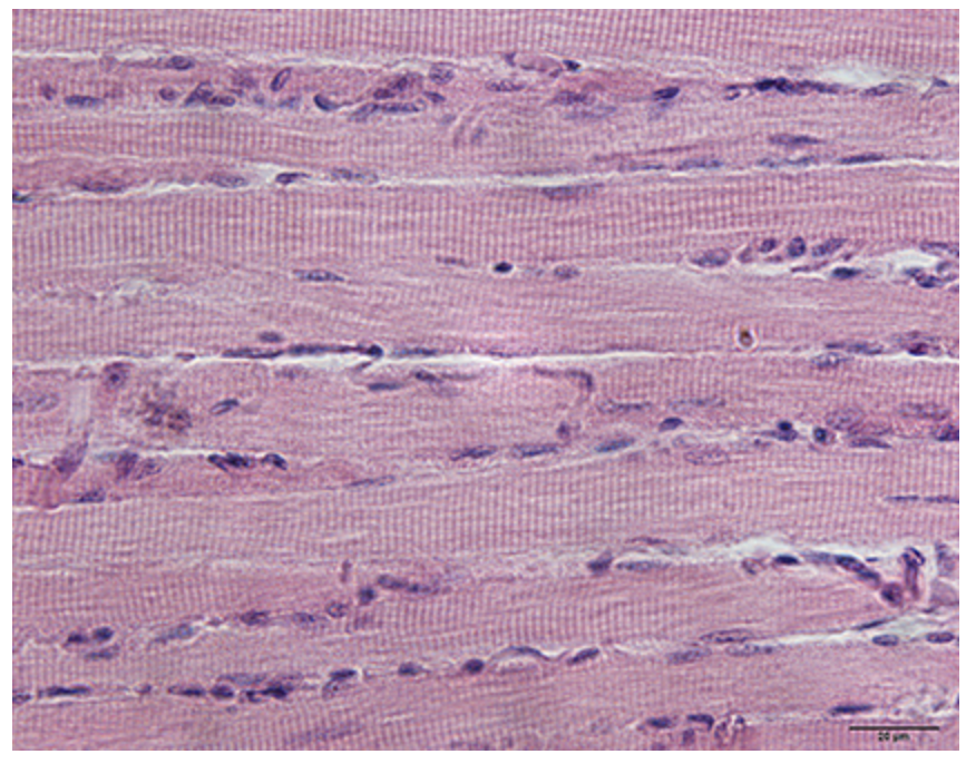 <p>What muscle is this?</p>