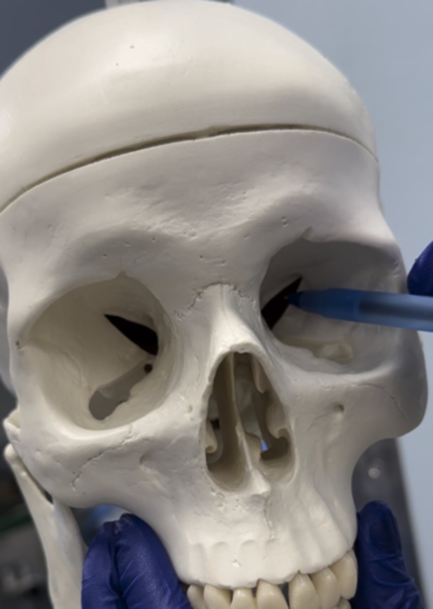 <p>The opening presented is the</p>