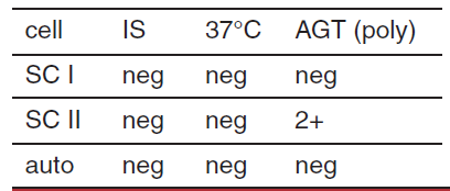 <p>possible interpretation of antibody screen </p>
