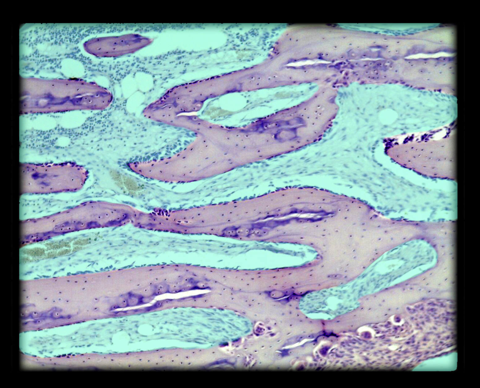 <p>Marrow Cavity in spongy bone</p>
