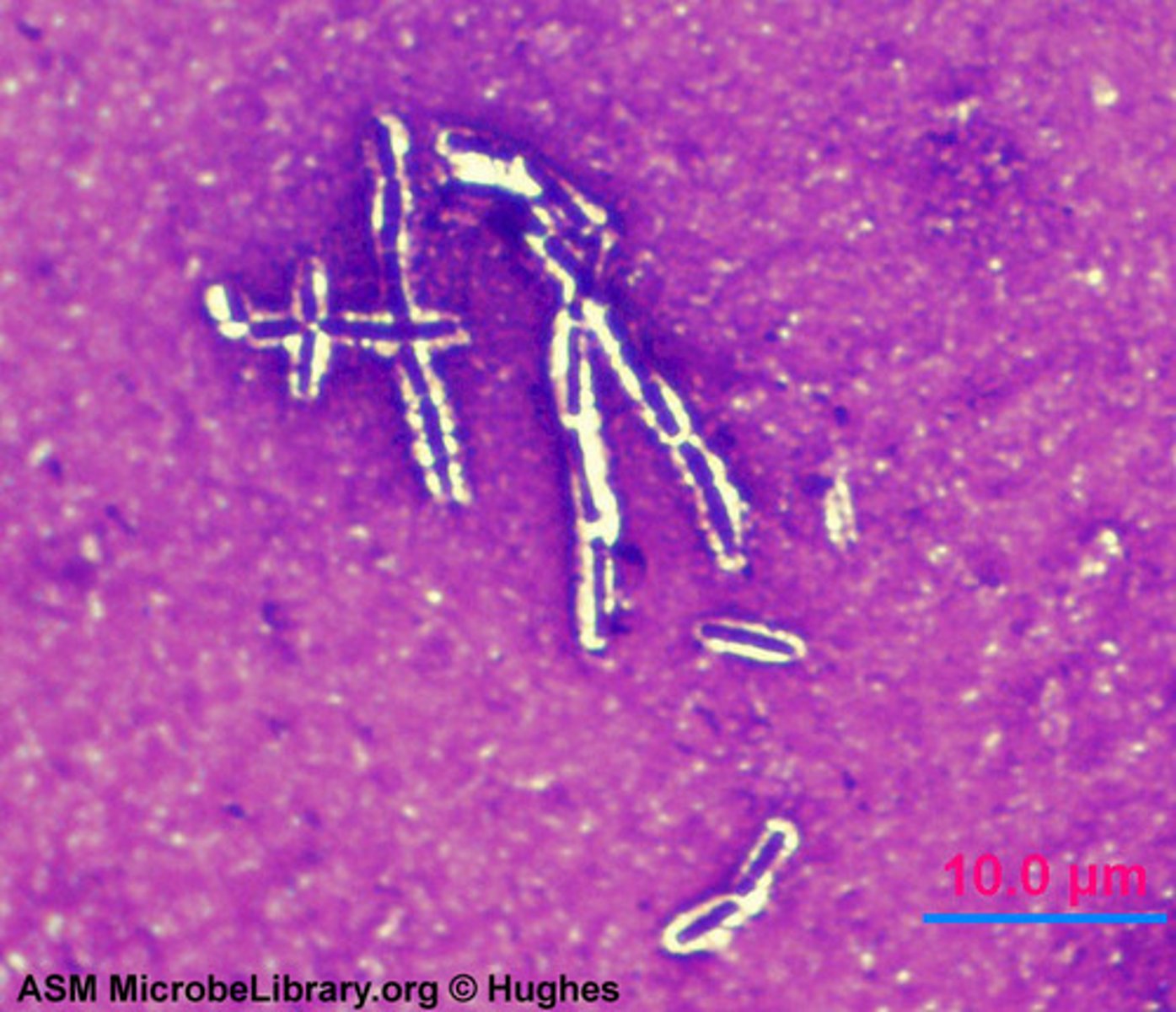 <p>What cellular structure is seen here?</p>