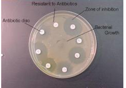 <ul><li><p class="has-focus">disc diffusion method (qualitative)</p><ul><li><p class="has-focus">involve placing<strong> ATB impregnated discs on an agar plate inoculated with bacteria</strong>. As the antibiotic diffuses into the agar, it creates a conc. gradient.</p></li><li><p><strong>clear zones of inhibition around the discs indicate the effectiveness of ATB</strong></p></li></ul></li></ul><p></p>