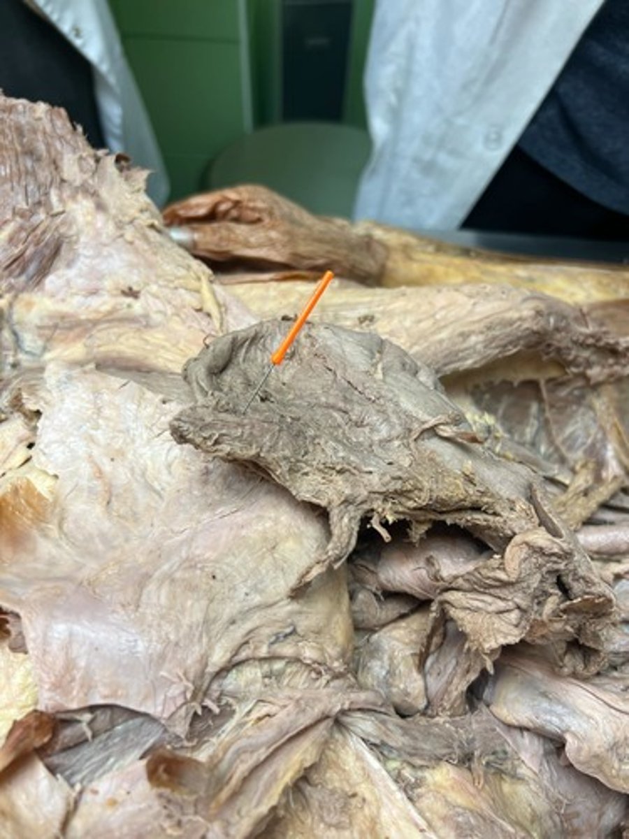 <p>abdominal part of oesophagus</p>