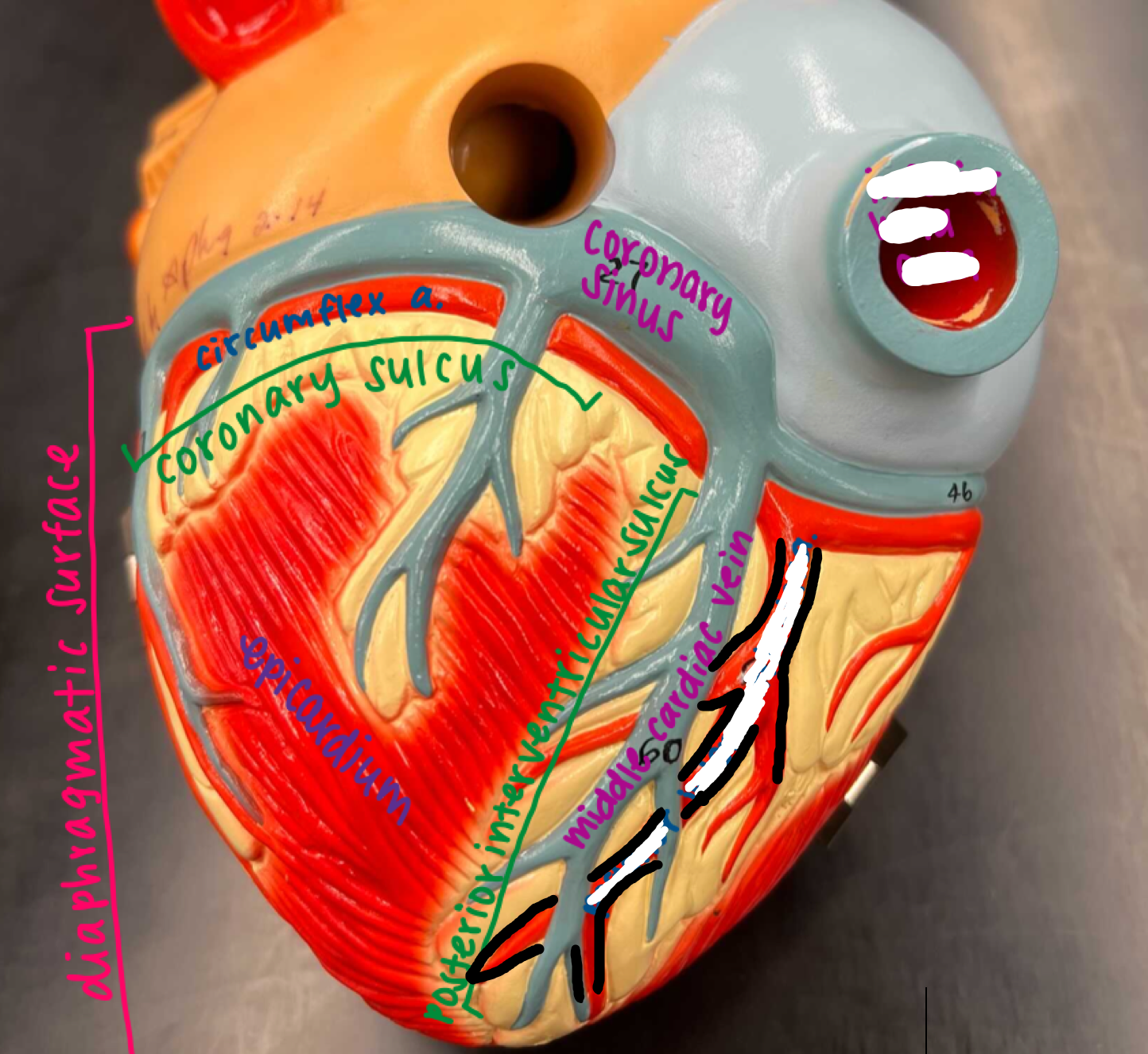 <p>On the bottom of the heart, the spiky red extension coming off the circumflex artery and just below the coronary sinus</p>