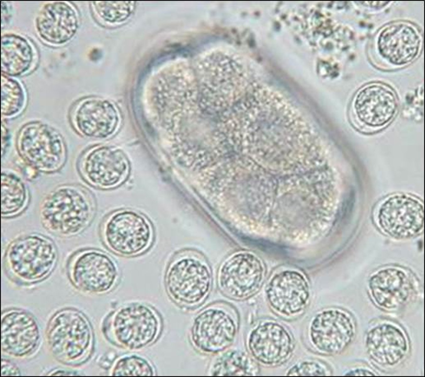 <p>Oocysts similar to these, approximately 10 to 12 um in diameter were seen on the fecal examination from a cat. What are they?</p>