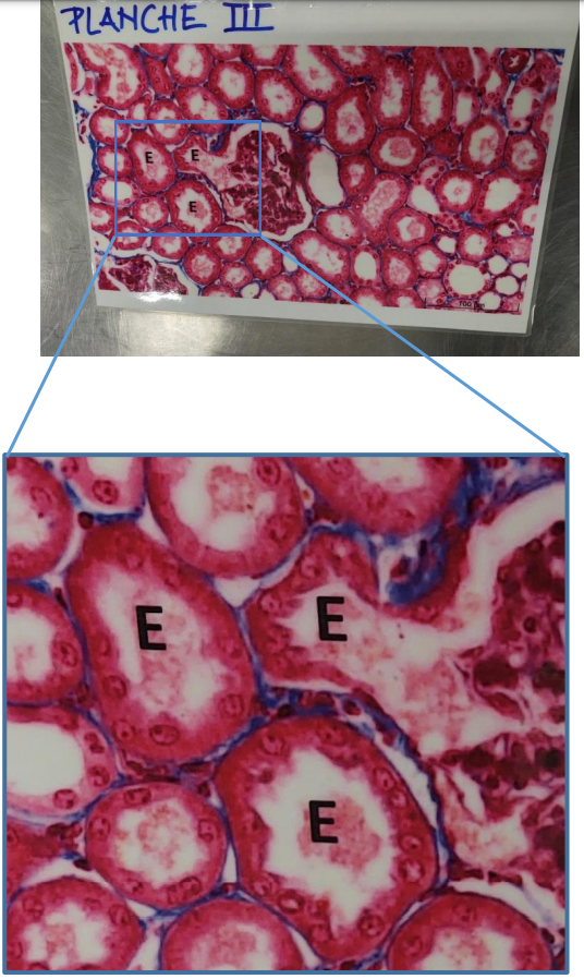 <p><strong>Post 2.</strong></p><p><u>Planche III: Histologisk billede</u></p><p></p><p><strong>Spørgsmål 5:</strong> Benævn strukturen E.</p>