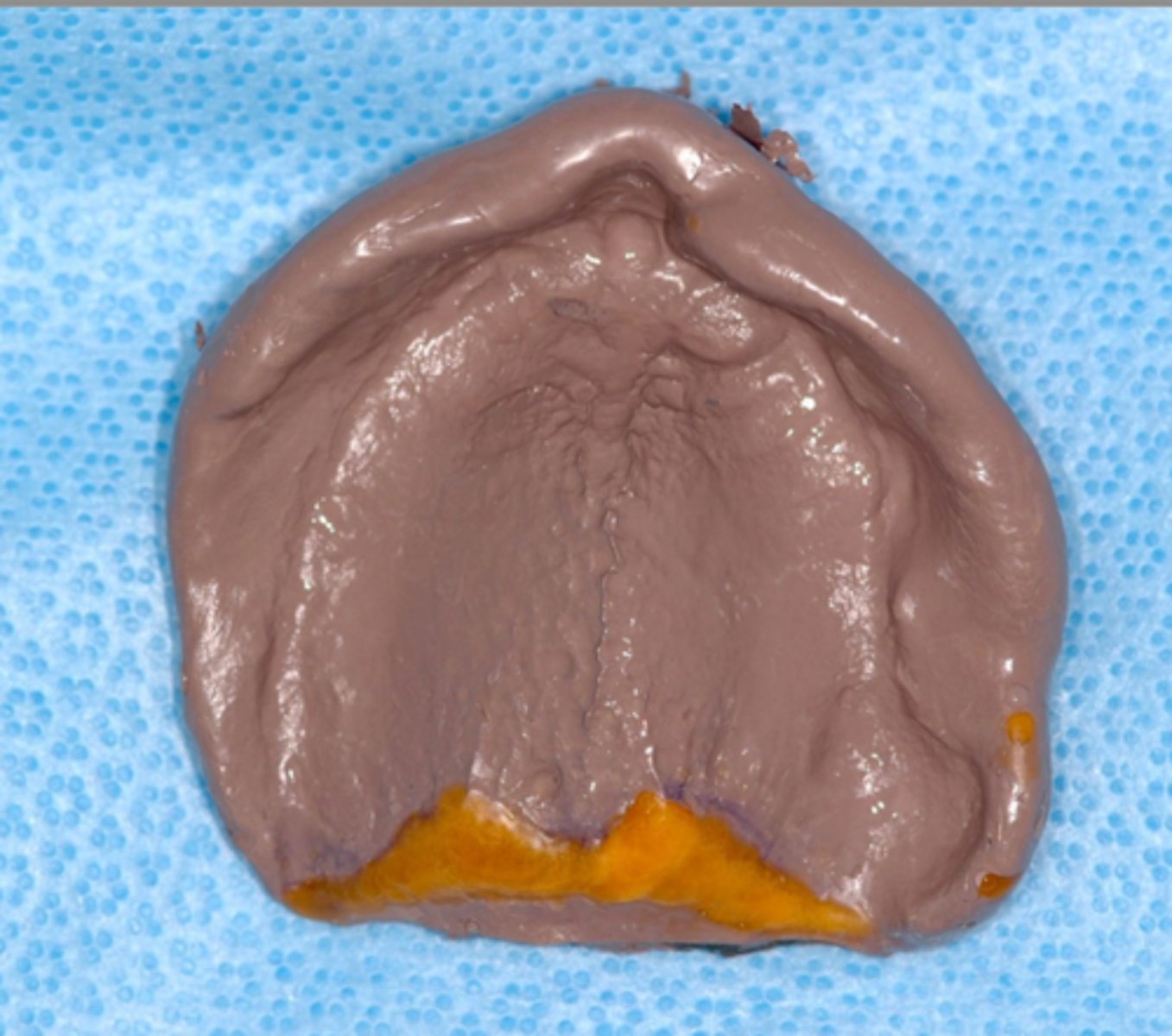 <p>What type of impression material?</p>