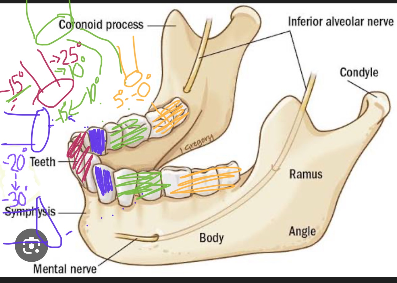 <p>What is the correct vertical angulation for mamdibular canines when using the bisecting technique?</p>