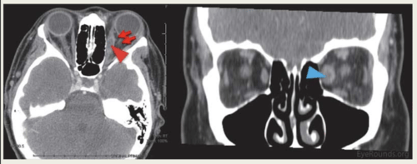 <p>MRI or CT scan</p>