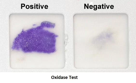 <ul><li><p>Cytochrome C oxidase, important component of the electron transport chain in aerobic bacteria</p></li><li><p>Test: Oxidase test (card) dark purple within 10-30 seconds indicates the presence of cytochrome C oxidase, reagent TMPD used and turns dark purple</p></li></ul><p></p>