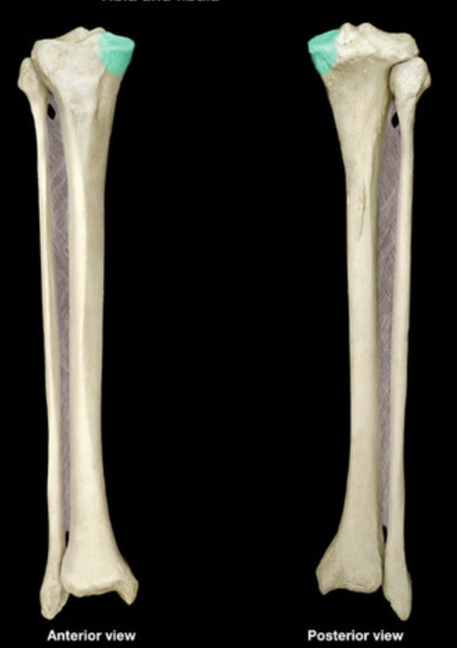 <p>Medial condyle of tibia </p>