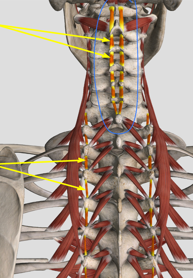 <p>What mm?</p><p>O, I, A bilateral and unilateral, N</p>