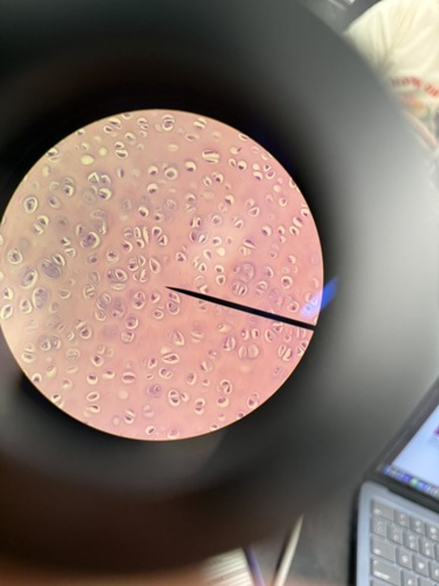 <p>Hyaline cartilage</p>