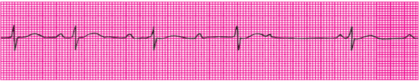 <p>Name this rhythm.</p>