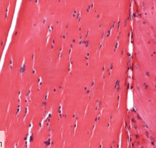 <p>type of connective tissue</p><p>notice the packed, parallel arrangement of fibers</p>