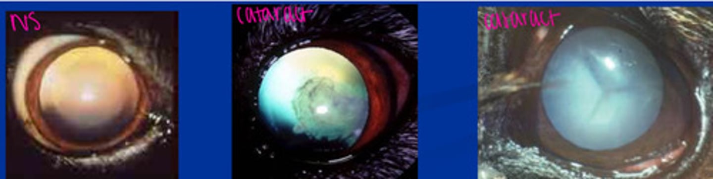 <p>First need to dilate with tropicamide 1%.</p><p>NS: hazy appearance, can see the lens</p><p>Cataract: completely blocks light</p>