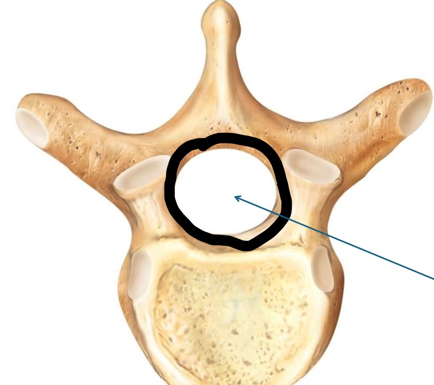 <p>What structure of the vertebra is this? </p>