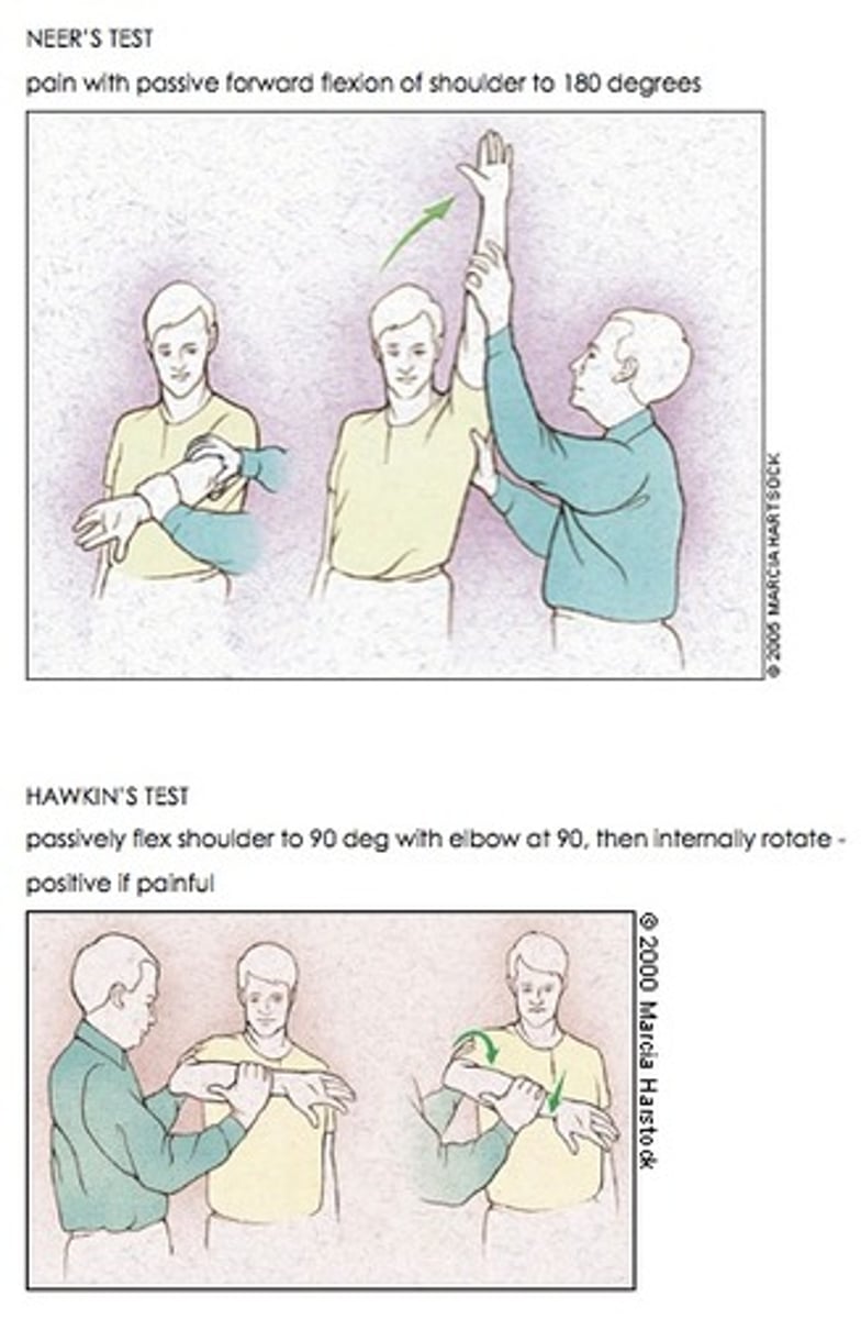 <p>Rotator cuff impingement - The examiner stabilizes the patient's scapula with one hand, passively flexing the arm while it is internally rotated. If the patient reports pain in this position, then the result of the test is considered to be positive.</p>
