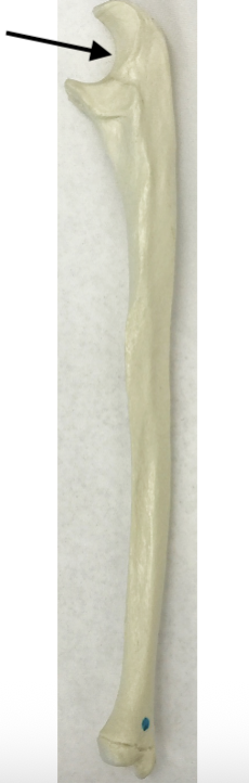 <p>What bone is this?</p>