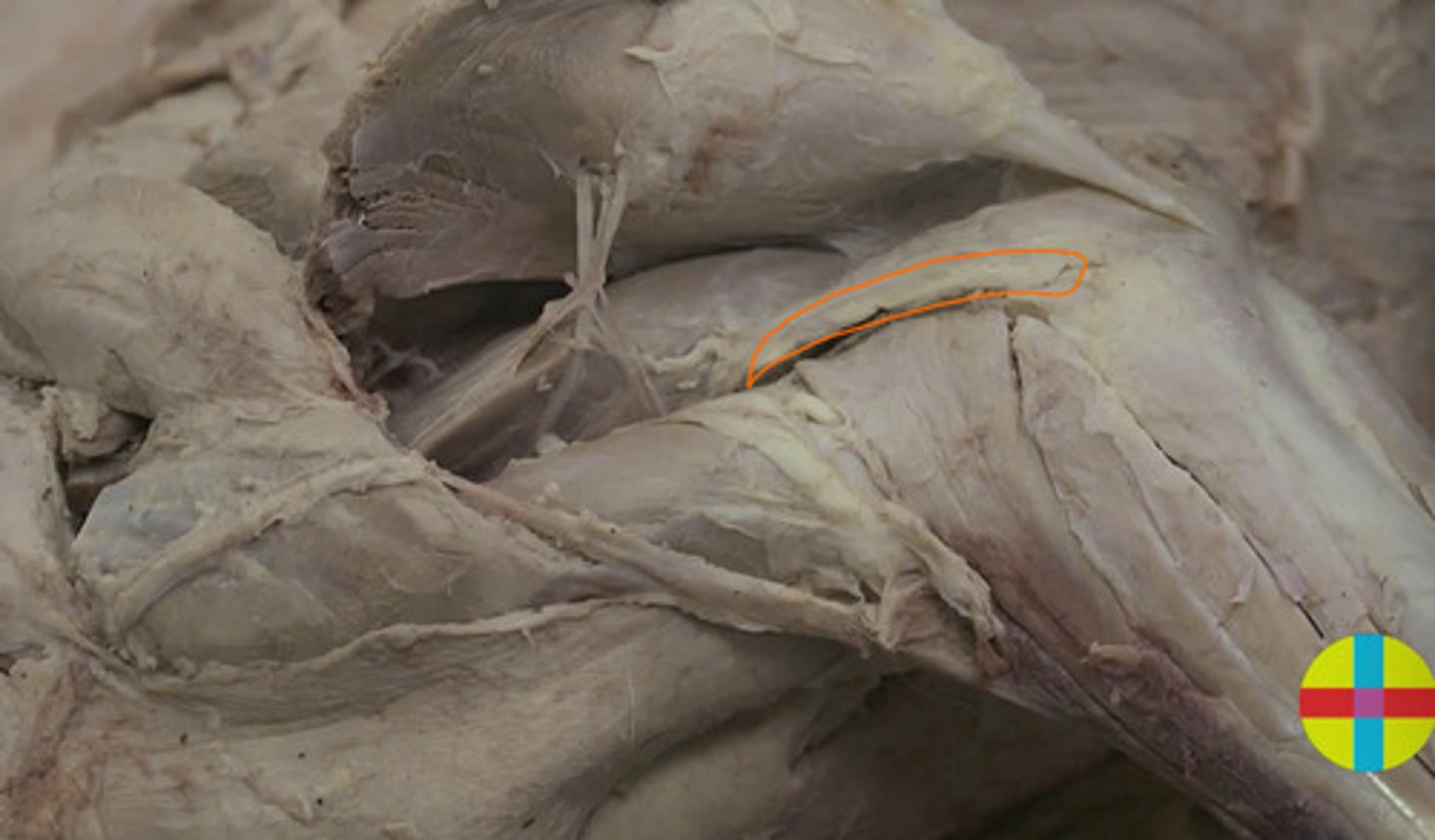 <p>se encuentra en el extremo caudal y distal del húmero sobre la articulación del codo y se fija a la cápsula articular. Está cubierto de la cabeza larga del tríceps.</p><p>Origen: fosa del olécranon</p><p>Inserción: Lt al olécranon</p><p>Función: extensor de codo.</p><p>Inervación: n radial</p>