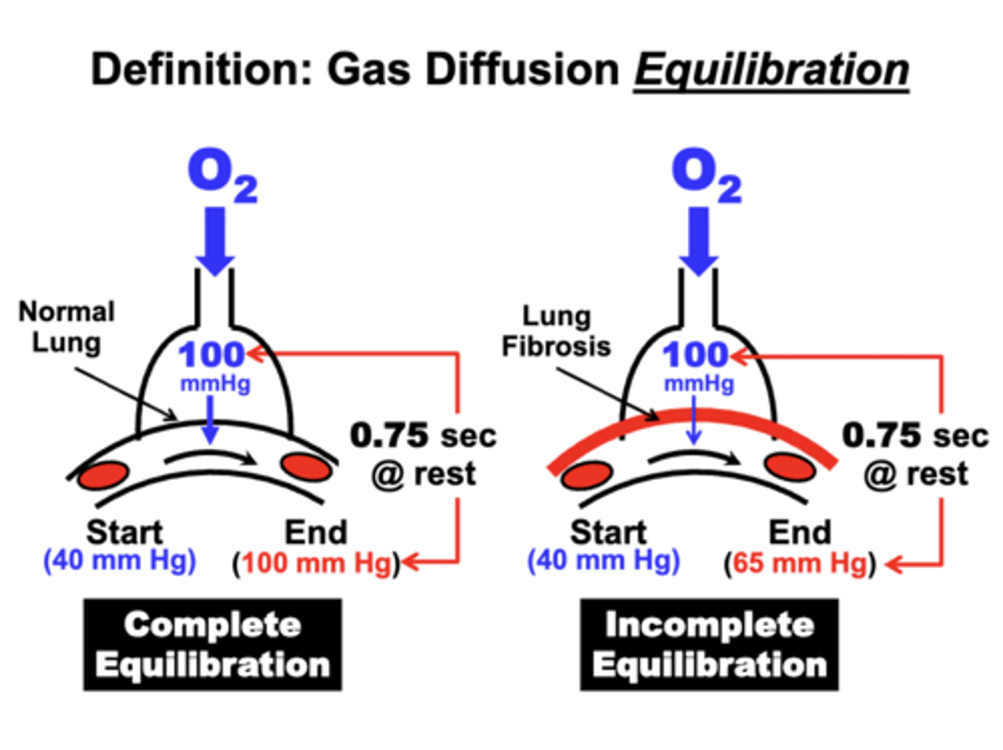 <p>occurs when blood PO2 fails to reach steady state value in alveoli during the available equilibration time</p><p>- due to decrease surface area or wall thickening</p><p>ex. lung fibrosis</p><p>- PO2 value in pulmonary arterial blood returning to the lungs is 40 mm Hg</p><p>- alveolar PAO2 is 100 mm Hg</p><p>- blood PO2 is only able to increase to 65 mm Hg</p><p>- fails to reach steady state value in alveoli during the available equilibration time</p><p>= eventually leads to hypoxemia and potentially hypercapnia</p>