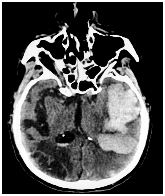 <p>What is shown in this imaging?</p>