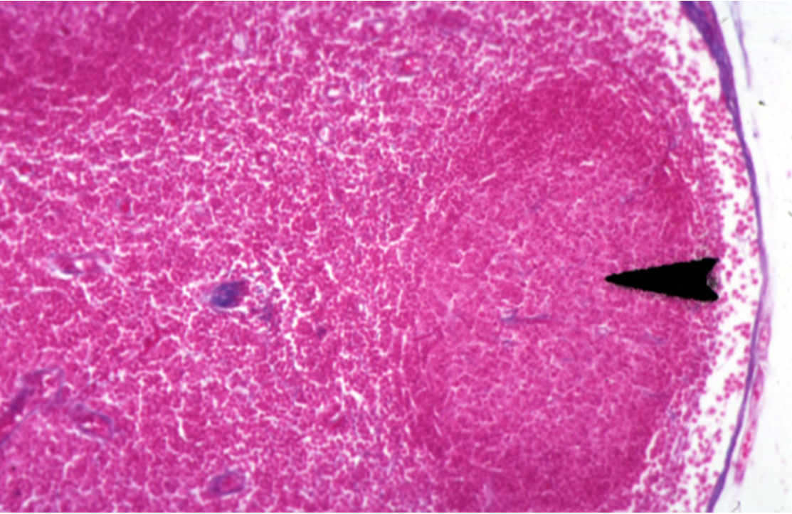 <p><strong>Lymph Nodes</strong><br>Capsule, germinal center and subcapsular sinus observed</p>