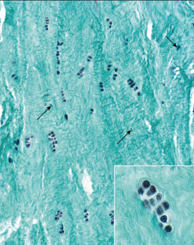 <p>fibrous cartilage major cell type + cartilage?</p>
